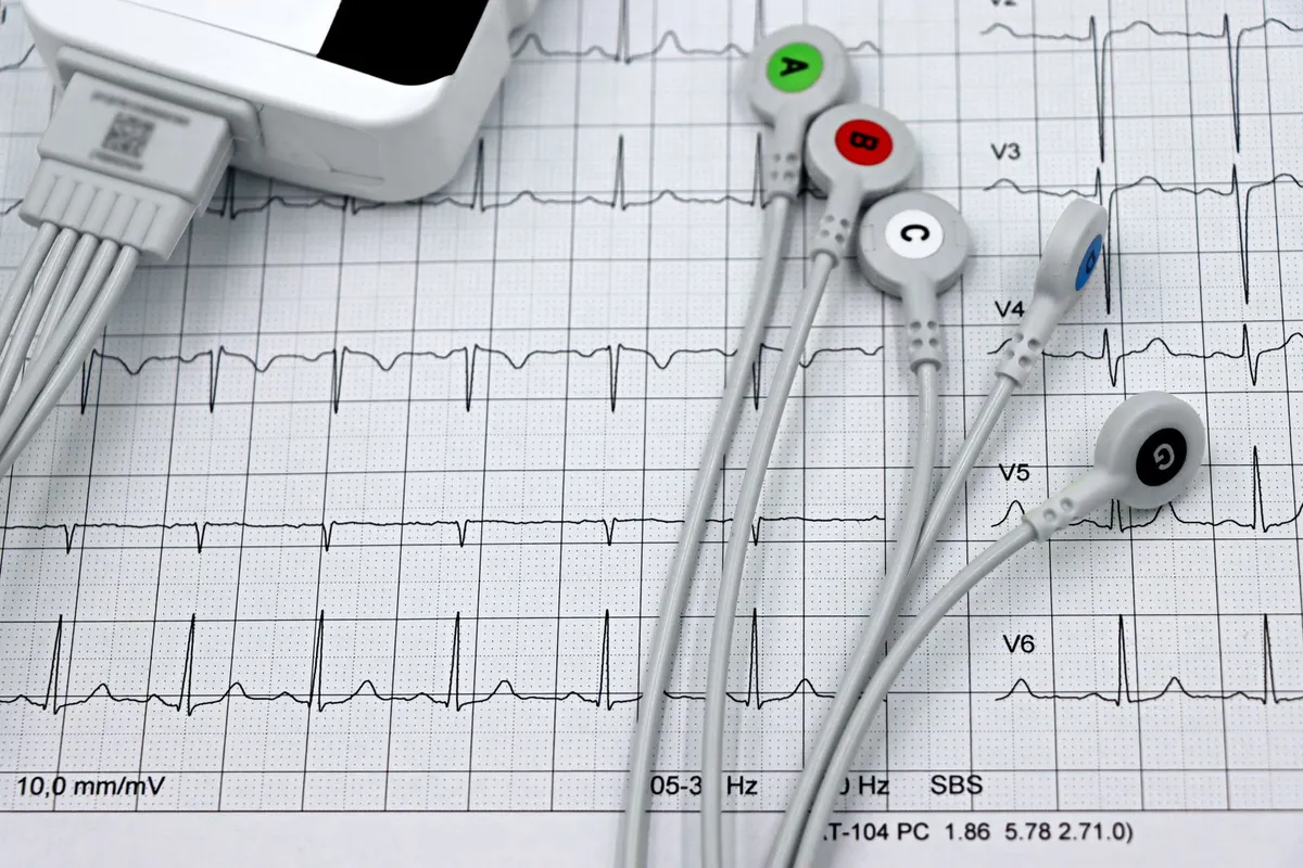 Electrocardiograma